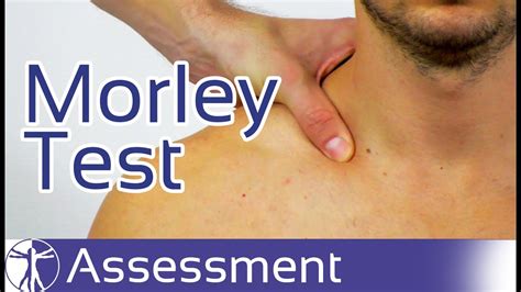 thoracic compression test|brachial plexus special tests.